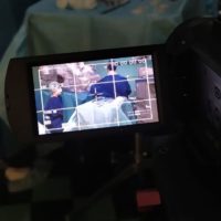 Руководитель отделения эндоскопической хирургии МОНИИАГ, проф. Попов А.А. провел «живую хирургию» по робот-ассистированной сакровагинопексии